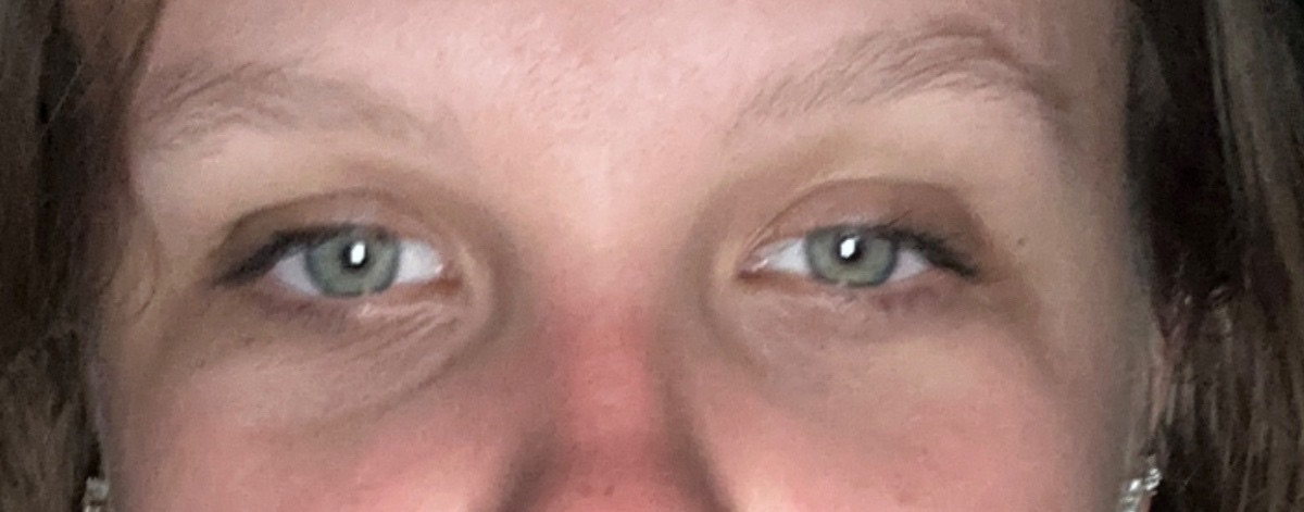 Lash AI before eye photo